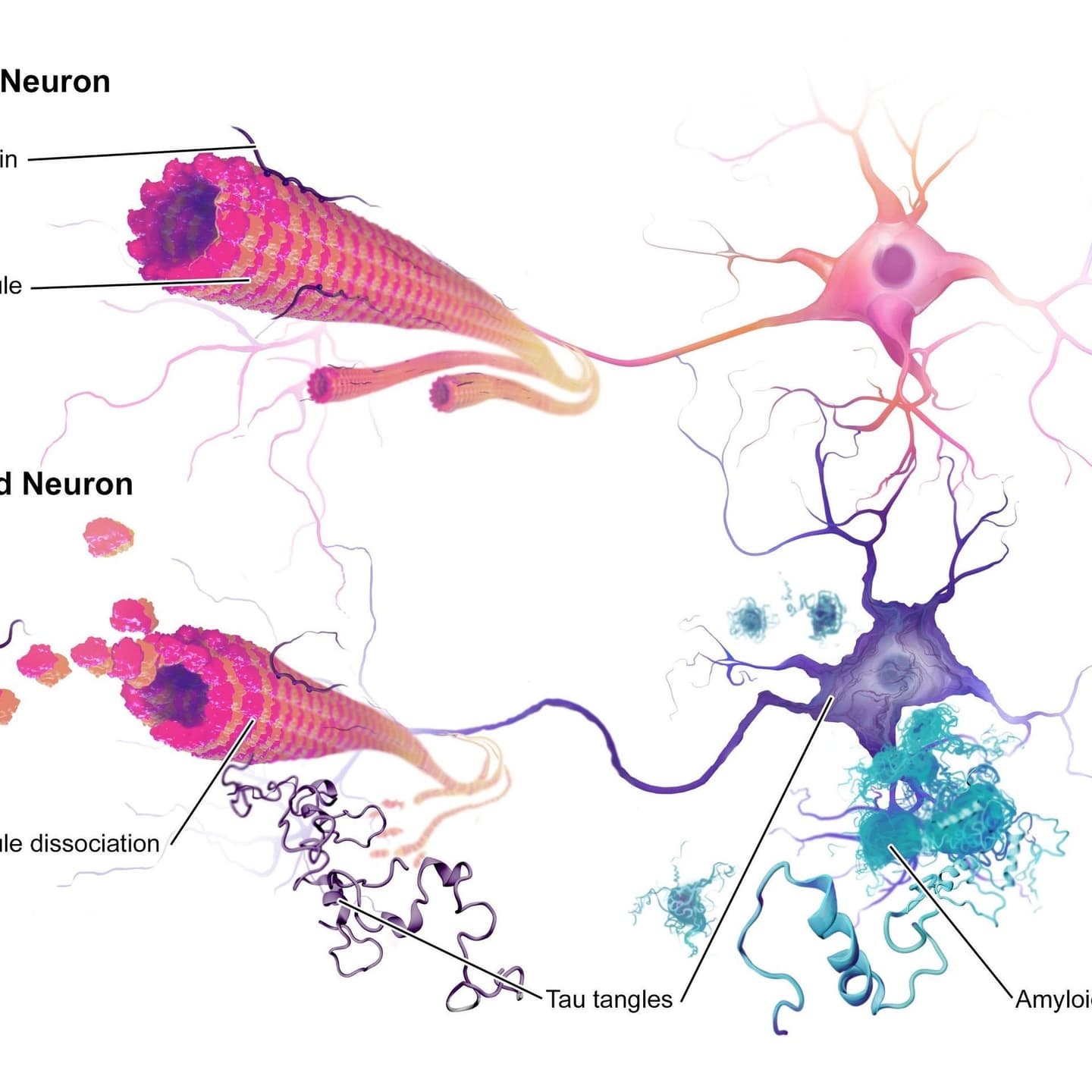 ProMIS Neurosciences Granted Fast Track Designation by U.S. FDA for PMN310 in the Treatment of Alzheimer’s Disease