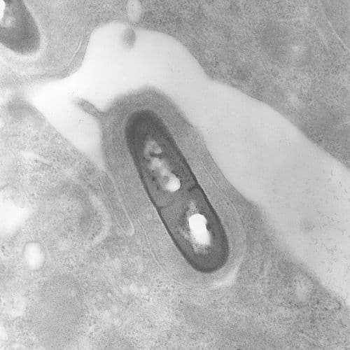 Scientists Use AI To Accurately Predict If Listeria Will Survive Food Industry Disinfectants