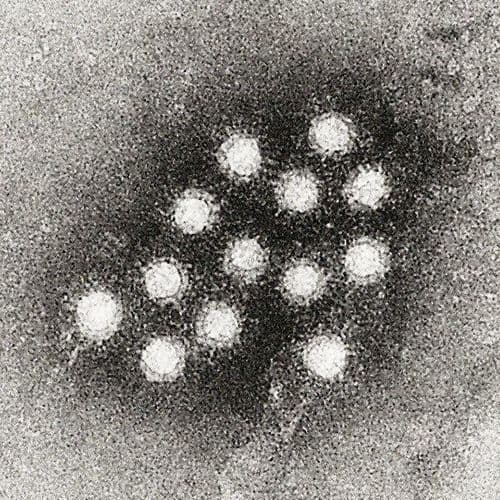 Seroprevalence of Hepatitis A Virus Infections Among Schoolchildren in Amran Governorate, Yemen