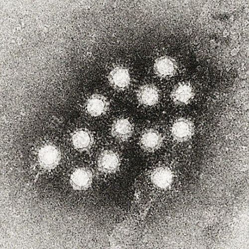 Hepatitis A in the Capital: Kyivvodokanal Responded to Accusations